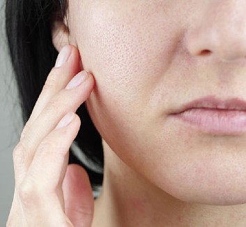 Trifractional RF Treatments